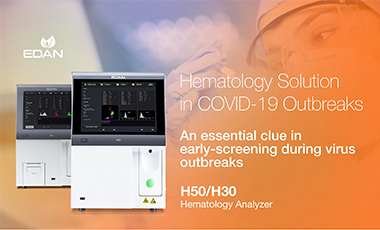 Hematology Solution in COVID-19 Outbreaks